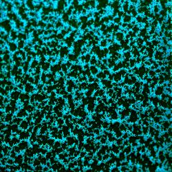 CANDY TEAL 2 COAT KIT (2 lbs.)